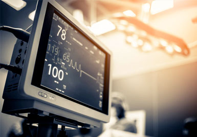 ECG Monitor